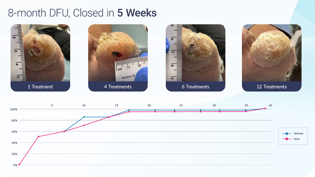 Vaporox 5 Weeks