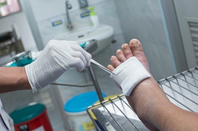 How Is a Diabetic Foot Wound Treated?
